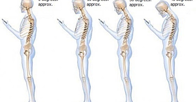 How To Fix “Text Neck” image