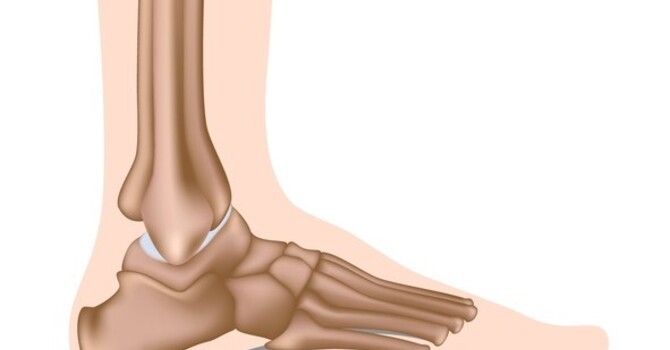 Active Release Techniques: EFFECTIVE treatment for plantar fasciitis image