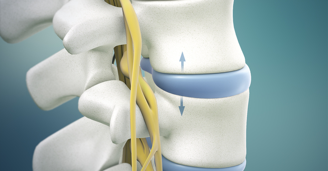 Spinal Decompression Therapy 